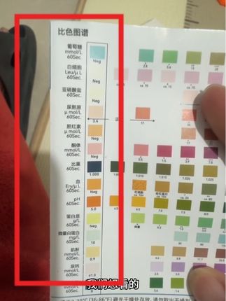 居家测尿试纸,可以看14项结果#日常生活 #测尿试纸