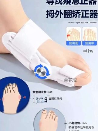#脚趾矫正器#矫正器