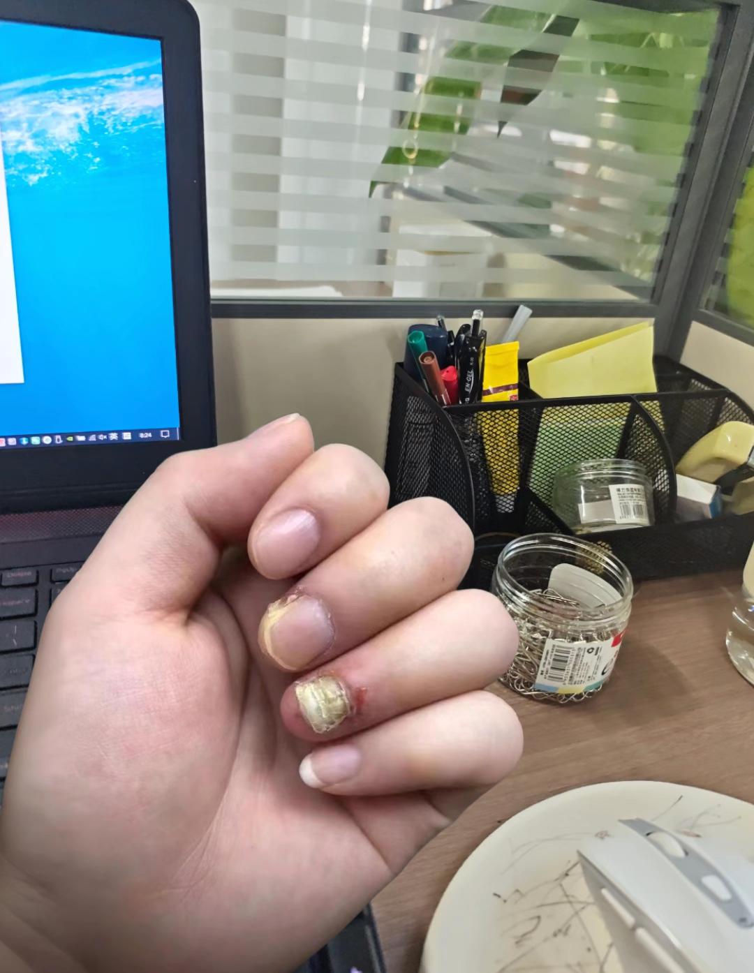 #日常分享