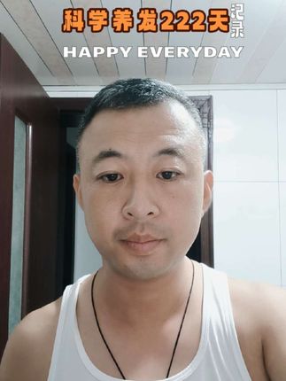 科学养发222天,正如荀子所言:“锲而不舍,金石可镂。”每日坚持,终见成效。💪✨#脂溢性脱发#脱发 #你的坚持终将美好 #自我成长 #岁月沉淀