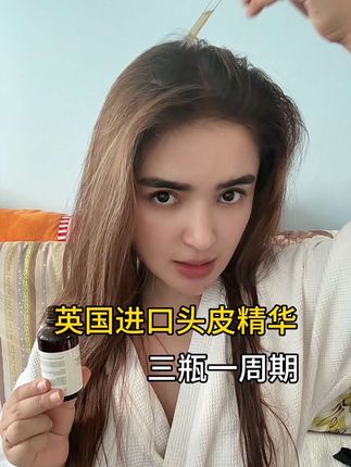 #英国头皮精华液 #增加发量 #保养头发 #头发少怎么办