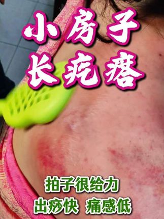 小房子疙疙瘩瘩怎么办?#拍打 #拍打养生 #是时候展现真正的技术了 #教你一招 #拍打工具