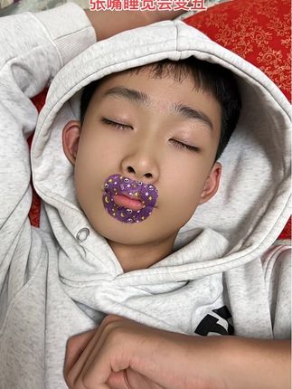 不管大人还是小孩经常张嘴睡觉会变丑影响颜值,要及时纠正可以试试这个#口呼吸矫正贴#张嘴睡觉会变丑 #张嘴睡觉怎么矫正 #口呼吸对颜值的影响 #腺样体面容