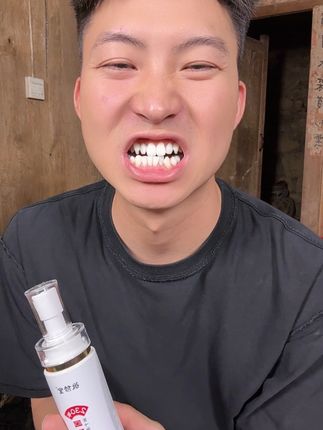 嘴巴有异味,牙黄牙黑你就试试它 支持大家试用