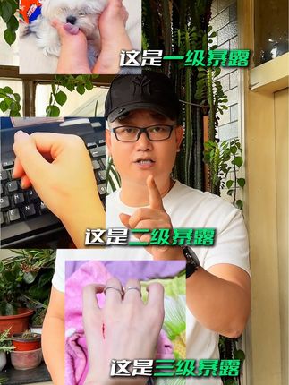 被猫狗抓了咬了要打疫苗吗 狂犬病常识大家一定要了解下#科学养宠攻略 #狂犬病毒 #新手养狗 #狂犬病 #萌宠好物