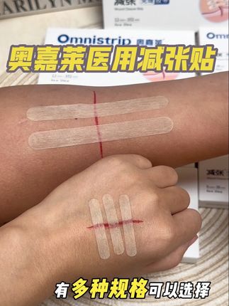 黑怕疤痕变大变丑的朋友,你就选这款奥嘉莱减张贴,真的有效果#奥嘉莱减张贴 #减张贴 #医用减张贴