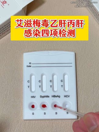亲密关系一定要测艾滋,艾滋超158万了,关键艾滋一旦感染就是一辈子了#恋爱 #情侣 #奔现 #感染四项 #自测健康