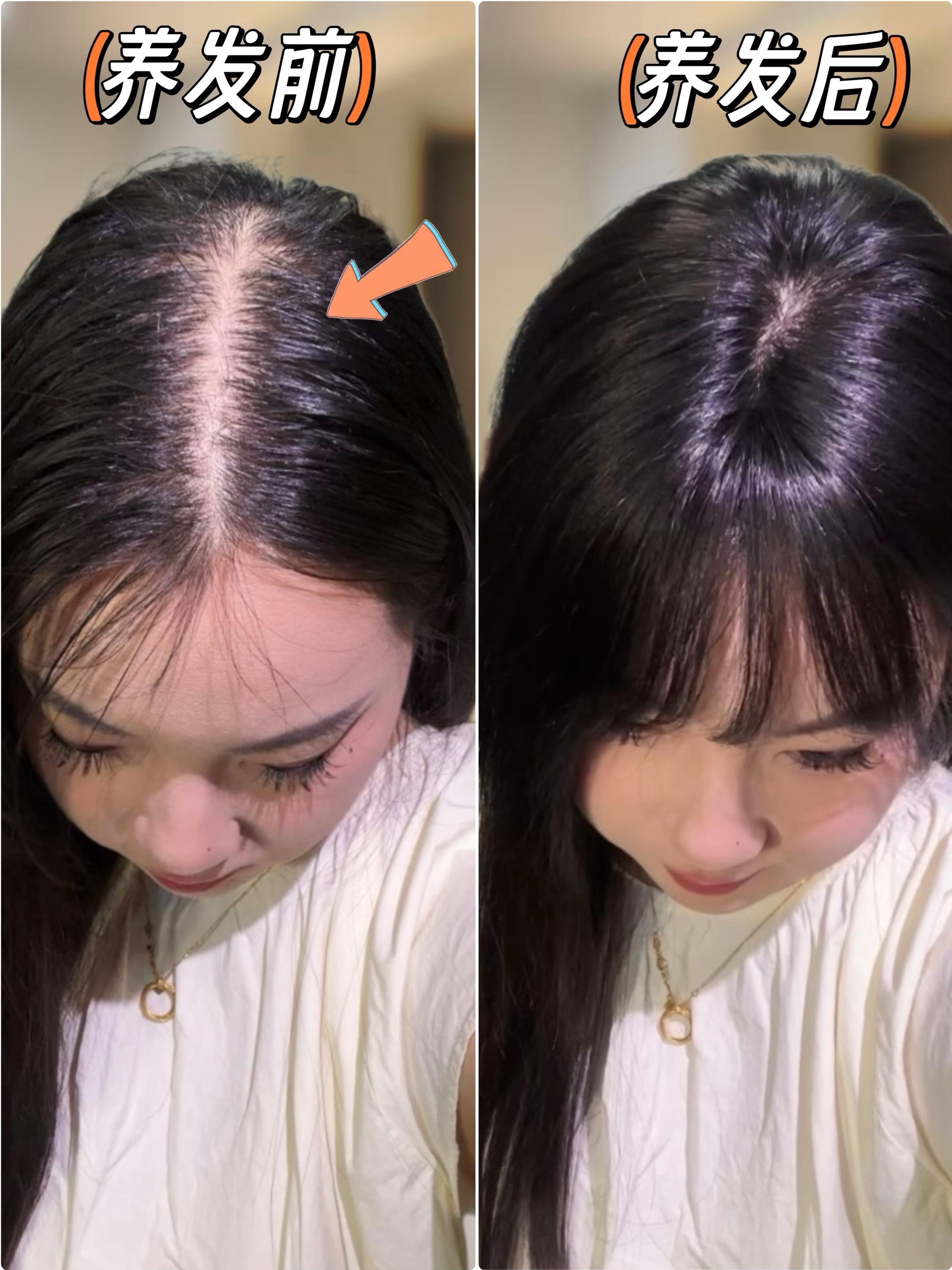 高缇雅生姜防脱洗发水。#上热门 自从被闺蜜种草了这款高缇雅的生姜洗发水,就一直无限回购,平时不喜欢味道太浓的味道,这个生姜的洗发水味道好闻不刺鼻,而且泡沫也绵密细腻,经常掉发头发出油的试试这款,不分男女,通用的,拍一发二到手两瓶。#好用的洗发水推荐 #控油清爽 #养发护发