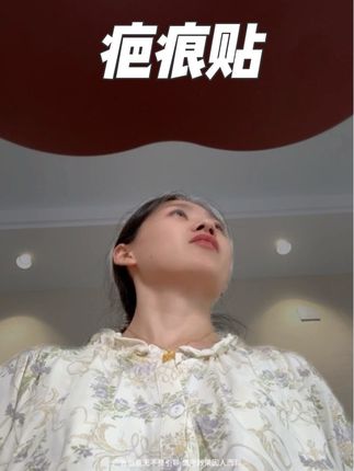 打算剖腹产的姐妹这款#疤痕贴 一定要提前准备,用和不用是真的不一样#孕妈 #剖腹产 #疤痕体质 #剖腹产妈妈