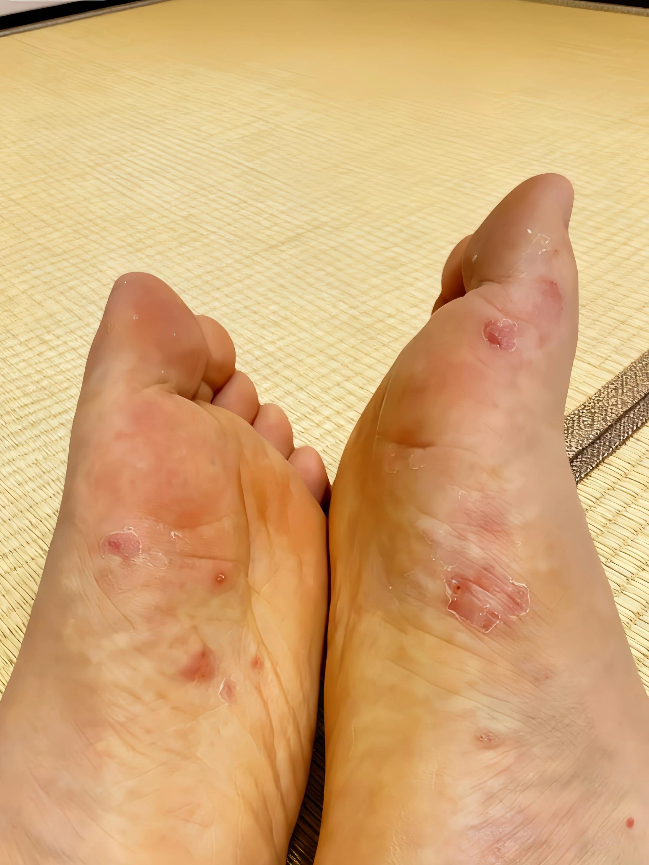 #我的小脚丫 #脚部护理 #太不容易了