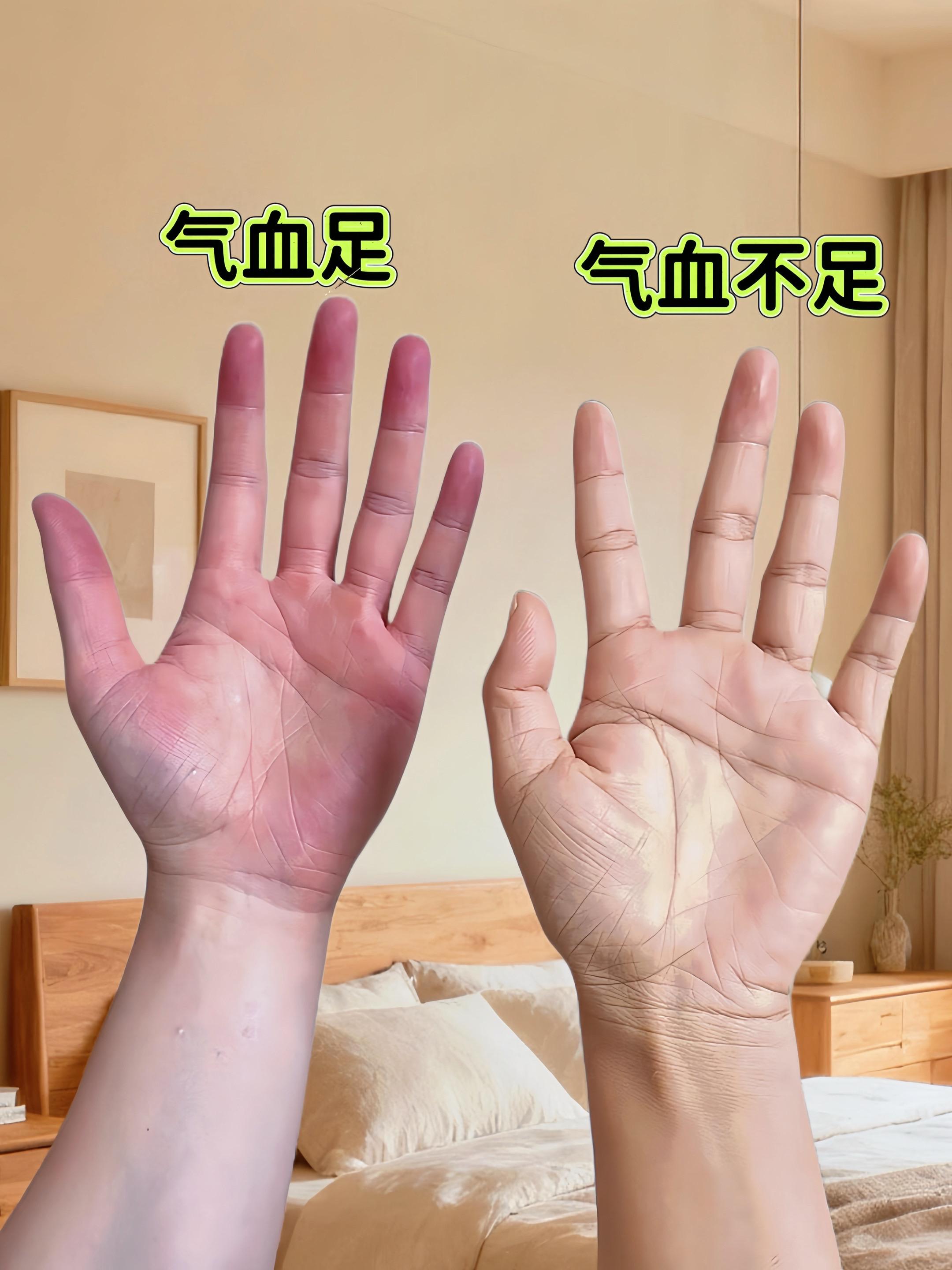 谁懂啊!这杯“气血茶”喝一周素颜都在发光。早上赶时间?抓一把扔保温杯里,开水一冲就能带出门!黄芪+党参打底,把气儿稳稳托住;当归少放提气色,再丢几颗枸杞增点甜,喝起来是淡淡的药香混着回甘,完全不苦! 坚持喝下来,明显感觉早上不怎么犯困了,连姨妈期那几天都舒服不少。女生真的要好好爱自己,不用搞复杂的,一杯暖茶喝对了,状态自然就上来~ #气血不足喝什么 #女生养生茶 #懒人养生攻略