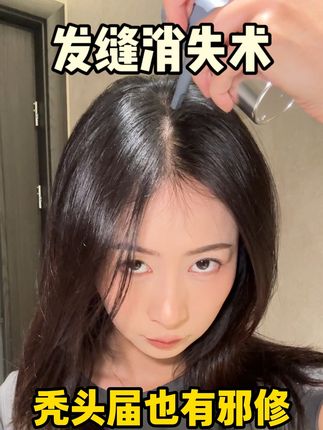 网传很牛的发缝消失术我现在也拥有啦! 太神奇了!#拯救发际线 #发际线粉 #发际线 #发缝 #种草好物