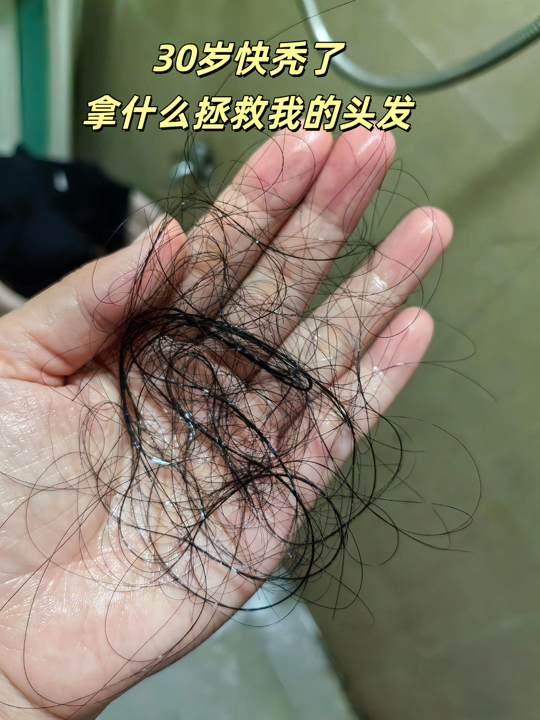 人到中年加上产后,脱发真的很严重,用了这个洗发露掉头发少了很多#种草好物 #洗发露 #好物分享 #防脱洗发水 #掉头发