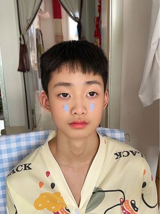 孩子倒睫毛就试试这个#倒睫矫正贴#倒睫怎么矫正 #孩子倒睫毛 #倒睫毛