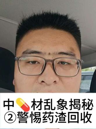 上一条关于中药材乱象视频已经下架了,还有不少人私信威胁我,我也知道你们是哪里的 中药材乱不乱,真的是你们说了,懂的都懂!
我在这里再次重申,此视频发布不是为了博取噱头 也不是为了诋毁中医 中医是我们五千年文化传承的根本 中医与中药材本质上是两码事儿 希望大家在选购中药饮片时瞪大眼睛,选择正规渠道、大品牌 治病救人,人命关天,切勿上当!#寻医问药少走弯路 #中药材 #中医传承 #传统文化传承 #正能量分享