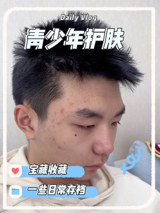 孩子脸上疙疙瘩瘩的 不要挤 不要扣 用袋鼠妈妈祛痘凝胶 很温和#护肤分享 #日常护肤