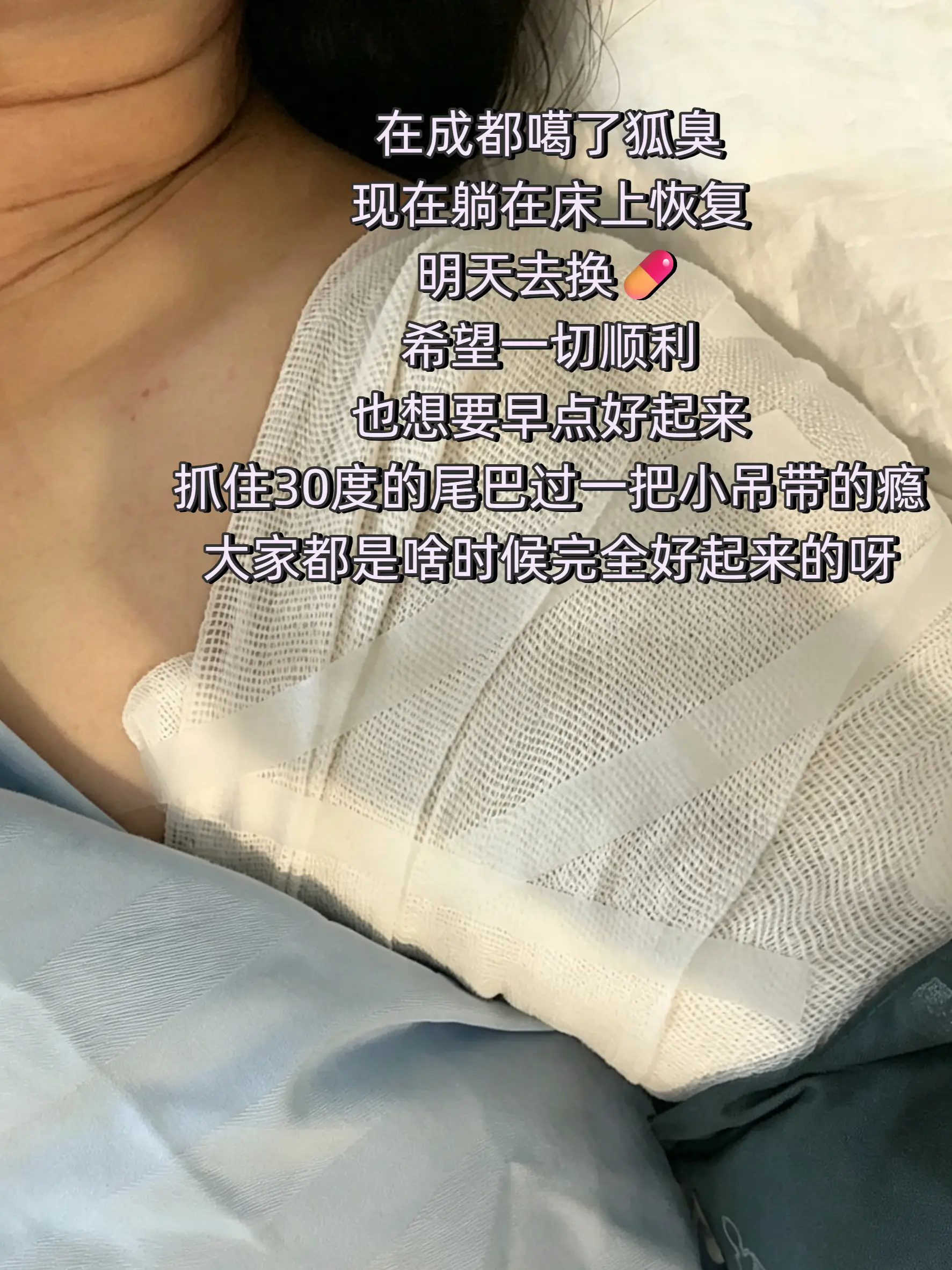 在成都把狐臭噶了,现在正躺在床上恢复。 今天第二天,手臂还是 - 抖音