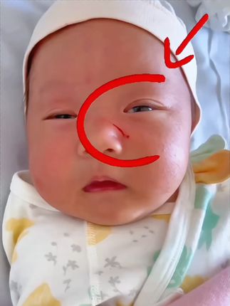 #待产宝妈 看过来,宝宝一出生就有长指甲,#待产包 一定要准备#指甲剪套装 避免宝宝抓伤自己,可以用到好几岁 #新手妈妈 #育儿经验分享