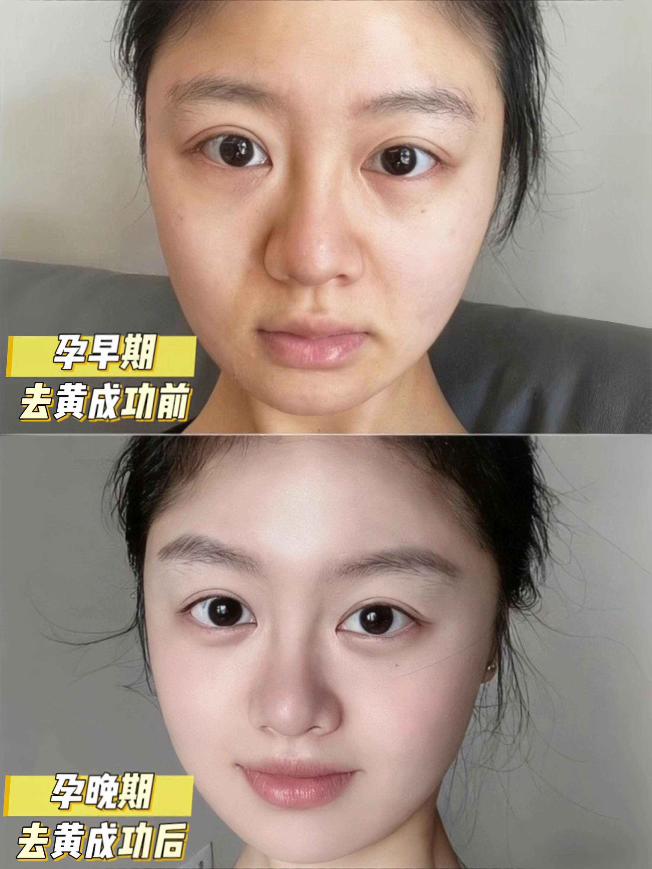 孕期护肤可不能偷懒哦!#怀孕 #一个身体两个心跳 #孕期护肤品 #孕妇面膜推荐 #面膜