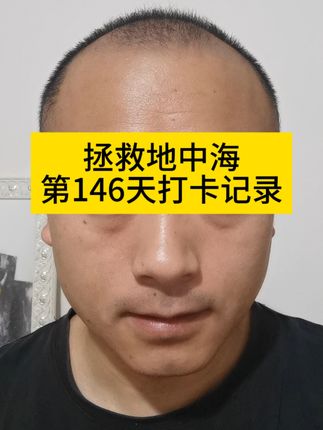 打卡第146天#拯救地中