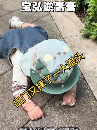 夏天穿的薄,难免磕磕碰碰,不处理,好久消不掉,这个真得备着!#淤青膏#宝宝摔跤防不胜防 #宝宝摔倒#宝宝磕碰#育儿经验