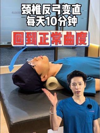 颈椎反弓,一个枕头帮您改善#颈椎#颈椎反弓#颈椎病#颈椎曲度