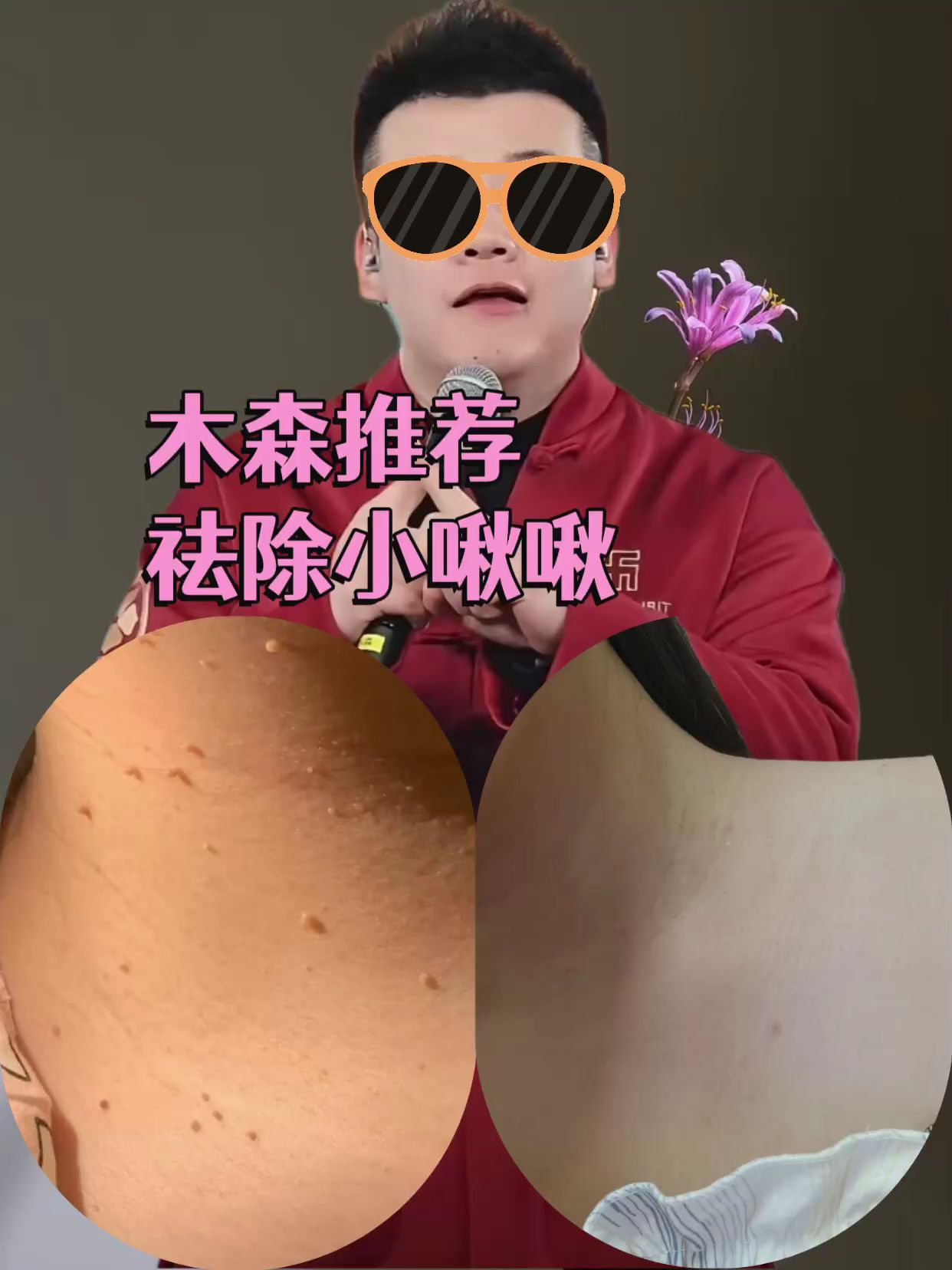 芙旋康鸦胆子克尤膏男女通用应季好物