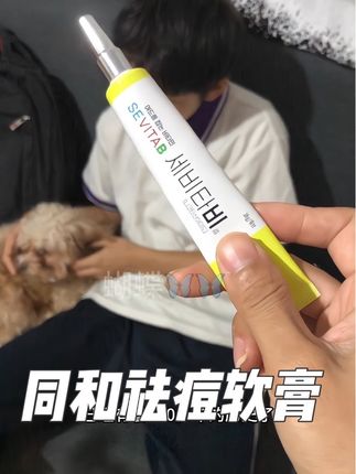 家有长痘娃的#同和祛痘膏 真的很不错!#祛痘膏#青春期孩子脸上的痘痘#青少年青春痘#青春痘的烦恼