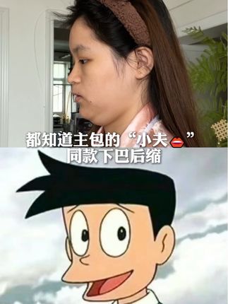 怪不得女明星都漂亮!还得是明星严选!#口呼吸对颜值的影响 #口呼吸 #变美小技巧 #女大学生 #变美逆袭