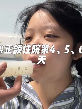 地包天,再也不见了!#地包天矫正#正颌手术 #上海九院