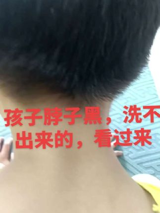 困扰我好久的问题终于解决了,黑脖子的福音,专治脖子洗不出来#PlPL黑茶卸妆油 #plpl黑茶卸妆油