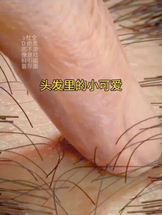 仁和药业百部酊喷雾剂男女阴用成人祛除虱子虱卵虱立净一扫光正品#长虱子怎么消除#消除虱子卵的小妙招#身上长虱子怎么消除#草本植物#百部酊喷剂