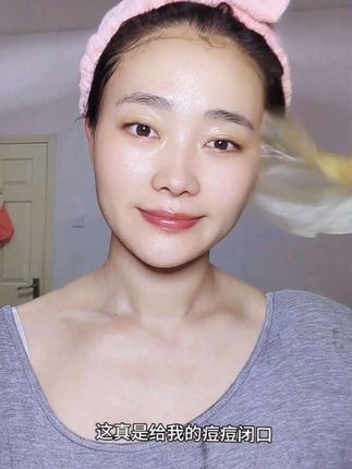 一周敷个两三片痘痘闭口, 算是遇到对手了#羽素大灯泡面膜 #羽素 #闭口 #痘痘 #面膜