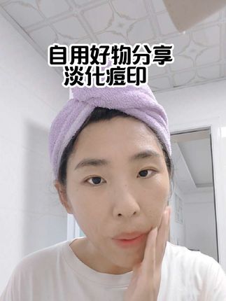 #痘印 #自用好物分享 #淡化痘印