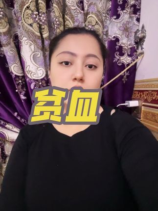 你们头晕吗宝贝儿们#好物推荐🔥 #打开美好生活