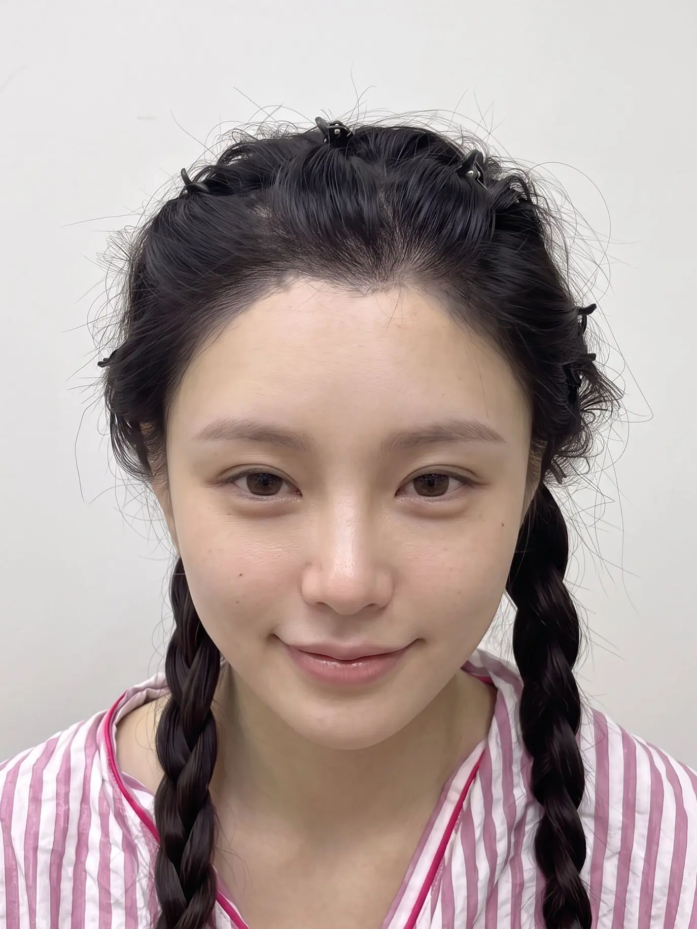 好担心,上海发际线能坚持多久?刚开始还美滋滋的欣赏找张鹏程做 - 抖音