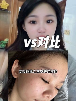 自用第四年!护肤极简化你会发现皮肤会越来越好 卡粉斑驳的姐妹快试试 孕妈妈都能用 放心入~