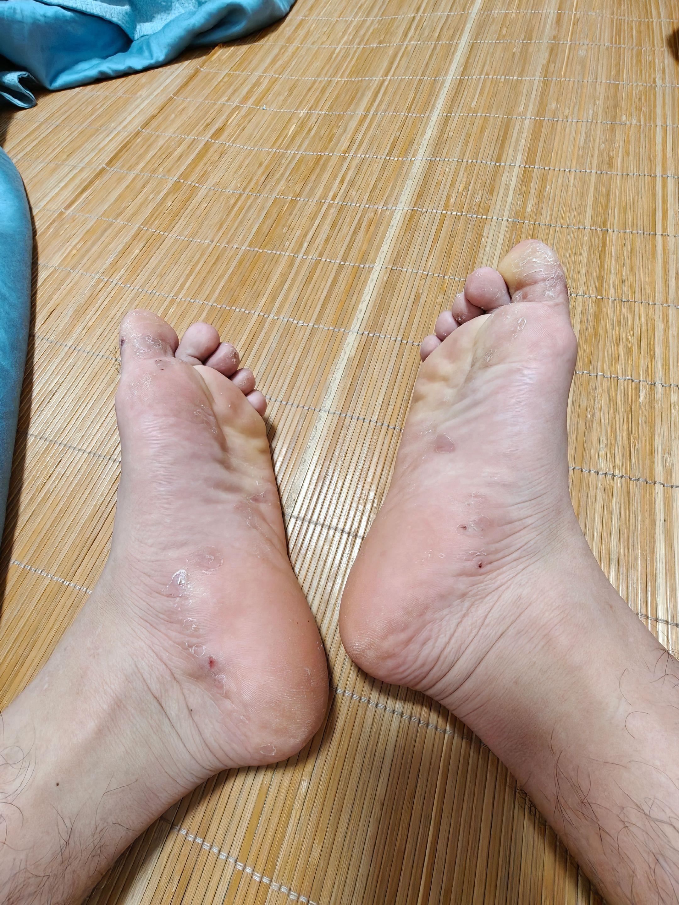 #可爱的小脚丫 #脚丫子 #脚 #我的脚脚 #脚丫