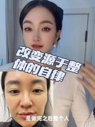 #逆龄抗衰 #变美就是这么简单 #面部提升 #好皮肤养出来 #每日分享 天意运动做起来~@海城市西柳镇名妍专业美容美体馆