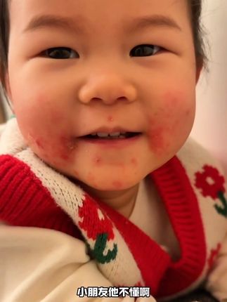 但凡家里有娃的 可孚这个疤痕凝胶得常备 刚好有活动 两支好划算#带娃好物 #可孚 #疤痕凝胶 #待产包