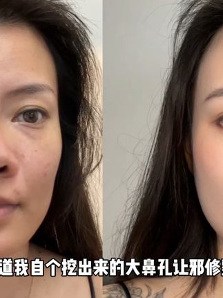 化妆都修不了的大鼻孔,你一定要试试!坚持用,真不是智商税!#大鼻孔 #鼻翼贴 #挖鼻孔 #小哑铃鼻贴 #鼻贴