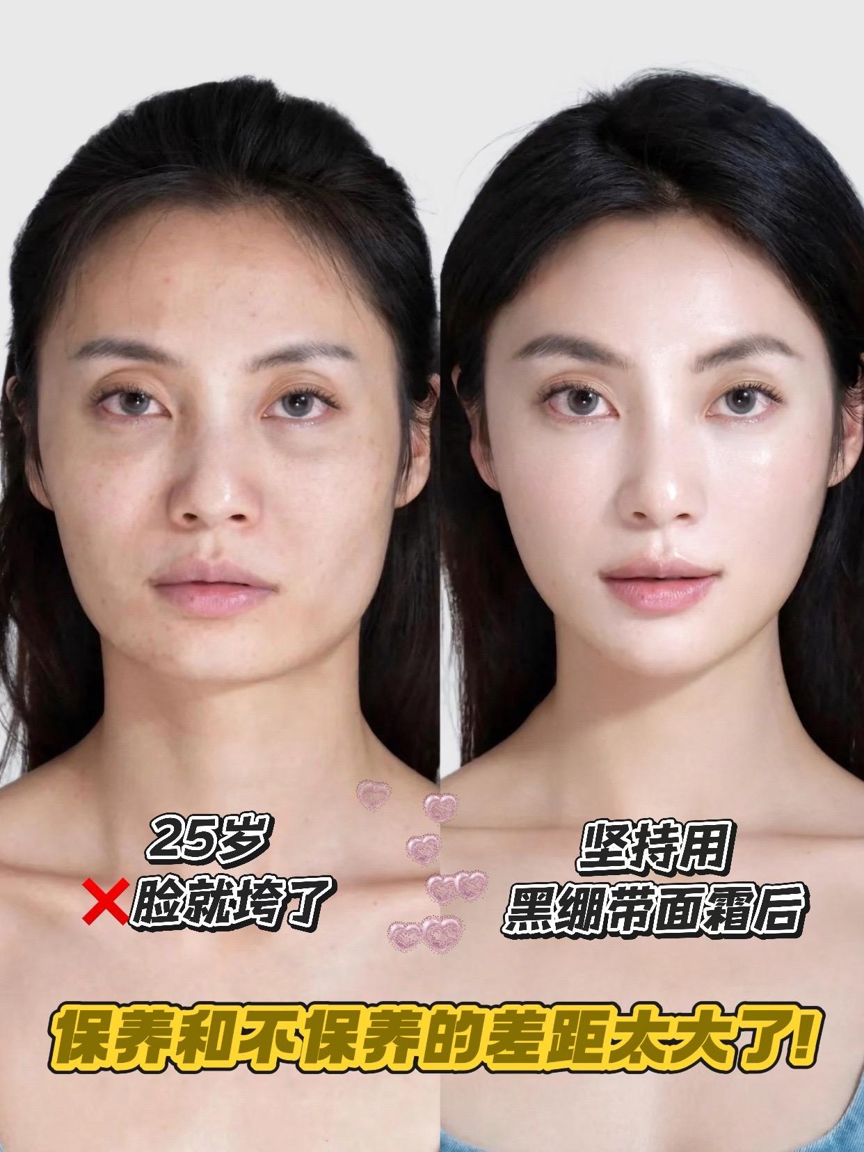 快快快~这个价薅到赫莲娜黑绷带正装量真的太划算了。之前因为熬夜,皮肤状态很差,暗沉、细纹都找上门来,用了一段时间黑绷带后,皮肤明显变得紧致有光泽,细纹肉眼可见地淡了,就连换季时容易敏感的问题也改善了不少,皮肤越来越稳定。没想到月薪三千也能用上贵妇品牌赫莲娜啦,闺蜜偷偷换号囤了好多!趁有库存赶紧冲#赫莲娜 #精致女人必备 #赫莲娜黑绷带面霜 #抗老面霜 #变美小技巧