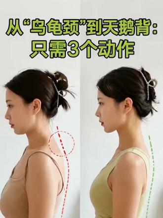 从‘乌龟颈’到天鹅背,只需3个动作”
凸起消了,肩膀不僵了,气质都变了
#消除富贵包 #改善圆肩驼背 #直角肩 #体态女王 #变瘦变美