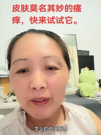 皮肤莫名其妙的瘙痒,快来试试这款毒必清。#毒必清