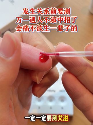谈恋爱前一定一定要测艾滋,因为艾滋肉眼是很难看出来的#恋爱 #奔现 #情侣 #感染四项 #自测健康