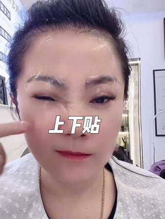 #上眼皮下垂 #眼纹细纹#魔贴世家眼贴 #魔贴世家法令纹贴