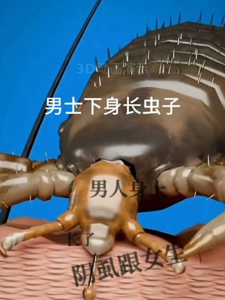 仁和复方百部酊虱必净喷剂男女阴虱成人祛除虱子虱卵立净一扫光正品#虱子 #虱子是怎么来的 #百部酊喷剂 #寄生虫 #虱子卵