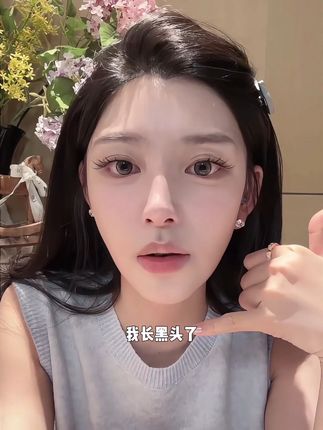 被韩女种草的黑头神器 #ally #种草 #黑头#仙女必备 #粉刺