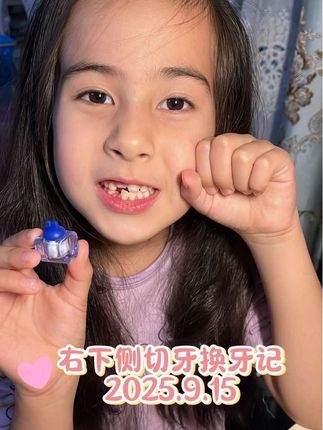 成长纪念|换牙 原来成长从不是突然的飞跃 而是每颗牙齿的悄悄萌动 是每个阶段的稳稳扎根🥰 #换牙记#成长记录#换牙期的孩子#乳牙盒 #乳牙收藏盒