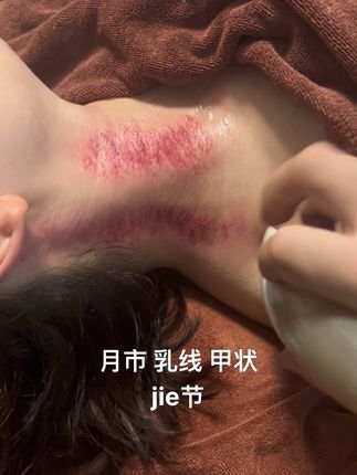 遇到问题不要慌不要害怕 让我来做大家的守门员 终有一天我们都会老去 终有一天我们都会花很多银子 不要问我为什么,因为每个人都很累 照顾好自己比什么都重要 古法运动+改善+调理 调理路径:一拍二刮三艾熏四饮食五锻炼六排垃圾七背后帮助你的老师 未来5年我们每个人都会和健康扯上关系 所有的粉丝注意了:切断来源,改变环境(情况就会慢慢缓解)问题只会越来越少,别问我为什么因为我们已经被pua了20年 #翁启万 #涨知识 #宝妈必看 #抖出健康知识宝藏 #女人